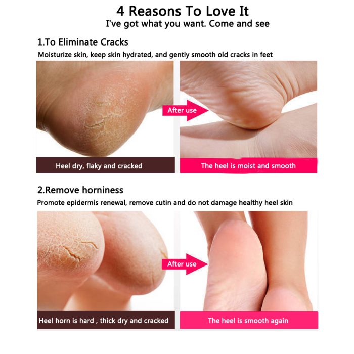 Silicone Heel Pad Socks for Pain Relief for Men and Women (Free Size) - 1 Pair (Standard)